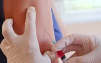 Bước tiến lớn trong điều chế loại vaccine mới phòng ngừa bệnh lao