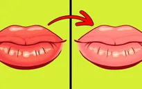 8 dấu hiệu của đôi môi tiết lộ tình trạng sức khỏe của bạn