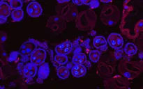 Thử nghiệm thành công bước đầu vi khuẩn kiềm chế virus sốt xuất huyết