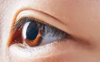 Mỹ cấp phép sử dụng kính áp tròng kiềm chế cận thị cho trẻ