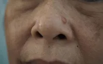 Làn da nguy cơ bị ung thư từ những yếu tố ít ai ngờ tới