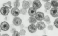 Chủng mới của virus HIV có thể là thách thức cho các xét nghiệm chẩn đoán