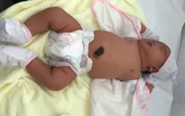 Hiếm gặp: Bé gái chào đời với cân nặng 5,2 kg