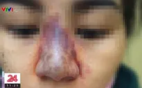 Một phụ nữ ngưng tim, ngưng thở sau khi tiêm thuốc gây mê tại thẩm mỹ viện