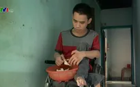 Khó khăn thẩm định khuyết tật ở địa phương