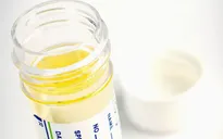 Xét nghiệm tại nhà phát hiện sớm ung thư tuyến tiền liệt