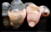 Chú gorilla trở thành ngôi sao mạng xã hội nhờ sở hữu "ngón tay người"