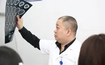 25% ca đột quỵ não xảy ra ở những người trẻ tuổi