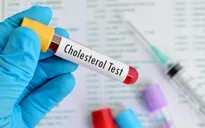 Lợi ích của điều trị sớm tình trạng cholesterol cao