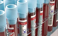 Sẽ có vaccine ngừa HIV vào năm 2021