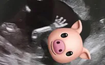 Khoe phim siêu âm thai nhi, Hồ Hạnh Nhi so sánh gia đình như một trang trại gia súc