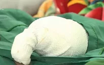 Báo động tai nạn do pháo nổ
