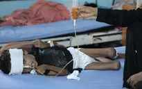 Yemen có thể mất toàn bộ thế hệ trẻ em vì nạn đói