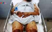 Điều tra vụ tạt axit, cắt gân chân rúng động tại Quảng Ngãi