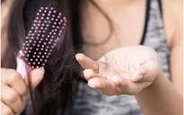 Rụng tóc nguyên nhân do đâu và cách chữa trị nhanh nhất hiện nay