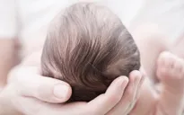 Rụng tóc vành khăn ở trẻ sơ sinh có phải là bệnh lý? Điều trị ra sao?