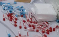 Vẫn quá tải xét nghiệm sán lợn tại Hà Nội