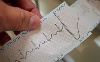 Nhịp tim như thế nào thì nguy hiểm?