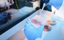 Kỹ thuật cấy ghép mới mở ra cơ hội duy trì khả năng sinh sản cho các bé trai mắc ung thư