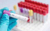 Gần 40% số ca nhiễm HIV mới tại Mỹ không biết mình bị nhiễm