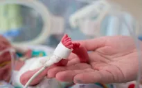 Tiến bộ y học giảm đáng kể tỷ lệ trẻ sinh non tử vong
