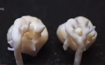 Anh tạo thành công hình ảnh 3D tim thai nhi