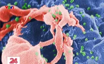 Thêm một bệnh nhân loại bỏ được virus HIV/AIDS khỏi cơ thể