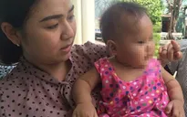 Giải cứu bé 8 tháng tuổi nghi bị mẹ nuôi bạo hành