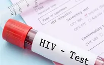 Khi tham gia BHYT, người nhiễm HIV có được chi trả 100% tiền thuốc?