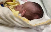Bé sơ sinh bị bỏ rơi, treo trên cành cây đang được điều trị tại Singapore
