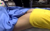 Bé trai bị bút chì đâm xuyên mông vì bạn nghịch dại