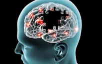 Điều trị Alzheimer bằng âm thanh và ánh sáng