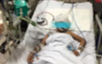 Dị dạng mạch não bẩm sinh, bé gái 9 tuổi suýt nguy kịch vì xuất huyết não