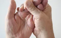 8 trường hợp tê tay mà bạn phải đi gặp bác sĩ ngay lập tức