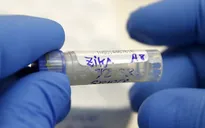 Brazil phát hiện vaccine chống sốt vàng hữu dụng với Zika
