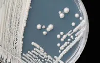 Hàng trăm người Mỹ nhiễm chủng nấm kháng thuốc Candida auris