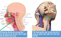 Sập giàn giáo, người phụ nữ phụ hồ bị xe rùa cắt gần đứt cổ