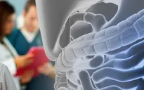 Số ca khám sàng lọc ung thư tăng đáng kể tại những bang nhận trợ cấp y tế Obamacare