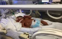 Em bé sinh ra từ người mẹ ung thư giai đoạn cuối: Bước đầu đây là ca sinh mẹ tròn con vuông