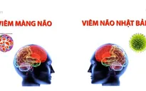Nhiều trẻ bị viêm màng não, viêm não Nhật Bản biến chứng
