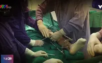 Kéo dài chân có suy giảm tuổi thọ?
