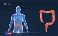 Những dấu hiệu và cách phòng ung thư đại trực tràng