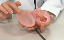 Công nghệ in 3D phát triển trong lĩnh vực y tế tại Hàn Quốc