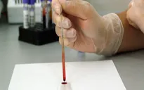 Phát minh thiết bị phát hiện vi khuẩn chỉ trong ít phút