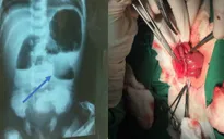 Phẫu thuật nhiều trường hợp dị tật bẩm sinh khó cho trẻ