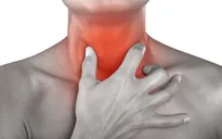 Nguyên nhân gây viêm họng, viêm thanh quản