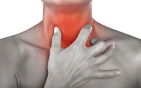 Viêm họng do thời tiết - dùng thuốc gì?