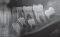 Chớ chủ quan với các bệnh lý về răng