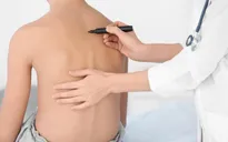 Phát hiện sớm cong vẹo cột sống ở trẻ