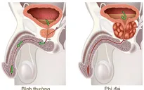 Tiền liệt tuyến và những công dụng tuyệt vời của Đông trùng hạ thảo